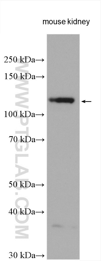 Western Blot (WB) analysis of various lysates using ACE2 Polyclonal antibody (21115-1-AP)