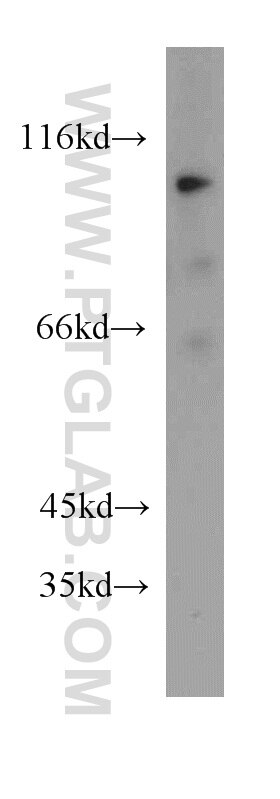 Western Blot (WB) analysis of human skeletal muscle tissue using ACE2 Polyclonal antibody (21115-1-AP)