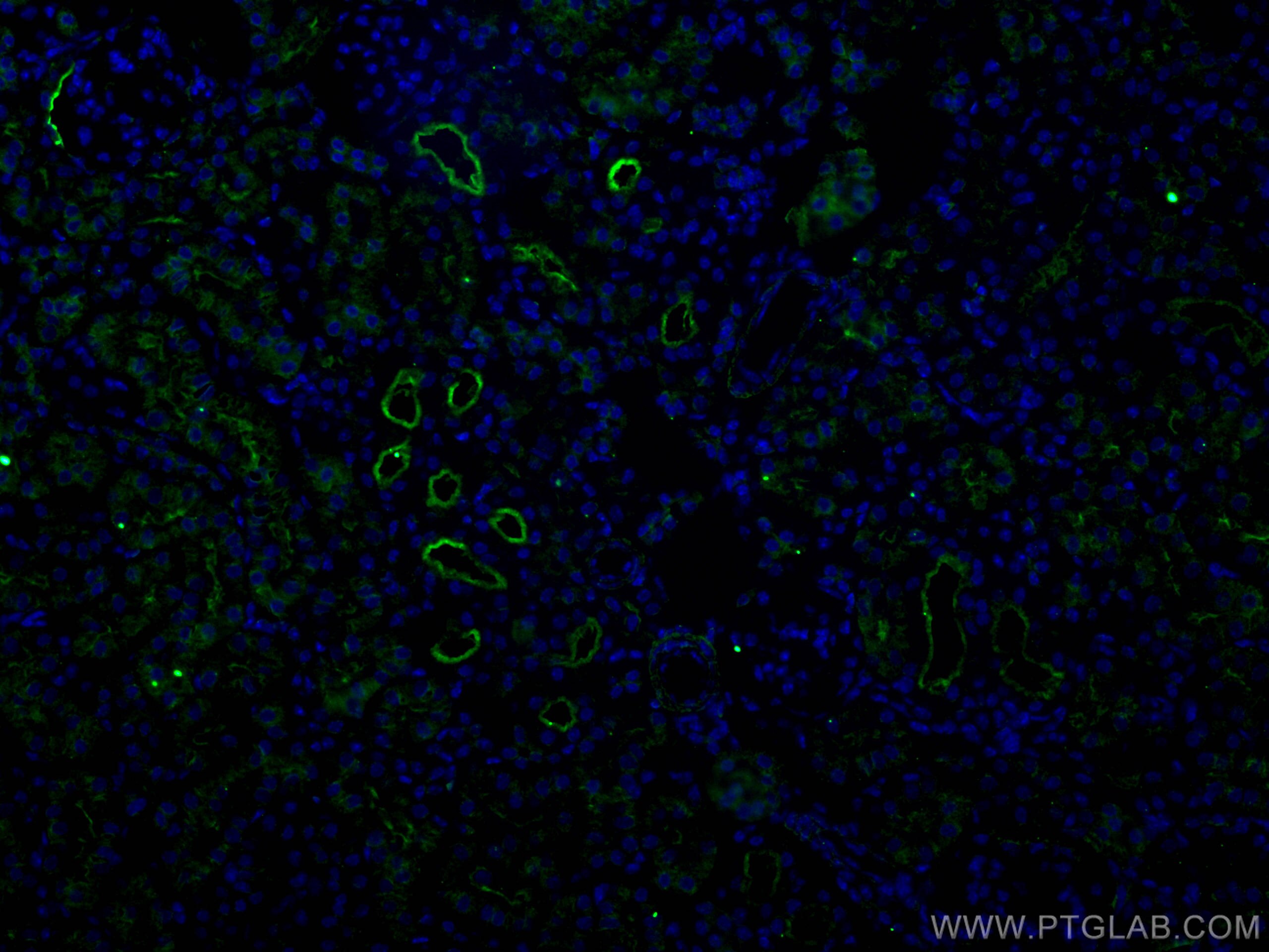 Immunofluorescence (IF) / fluorescent staining of mouse kidney tissue using ACE2 Polyclonal antibody (28868-1-AP)