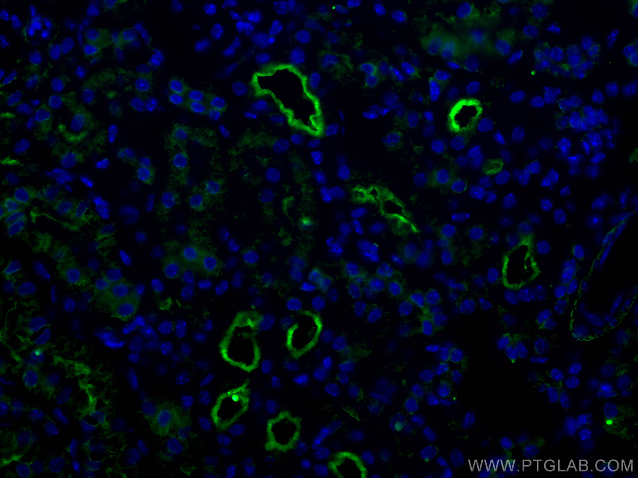 Immunofluorescence (IF) / fluorescent staining of mouse kidney tissue using ACE2 Polyclonal antibody (28868-1-AP)