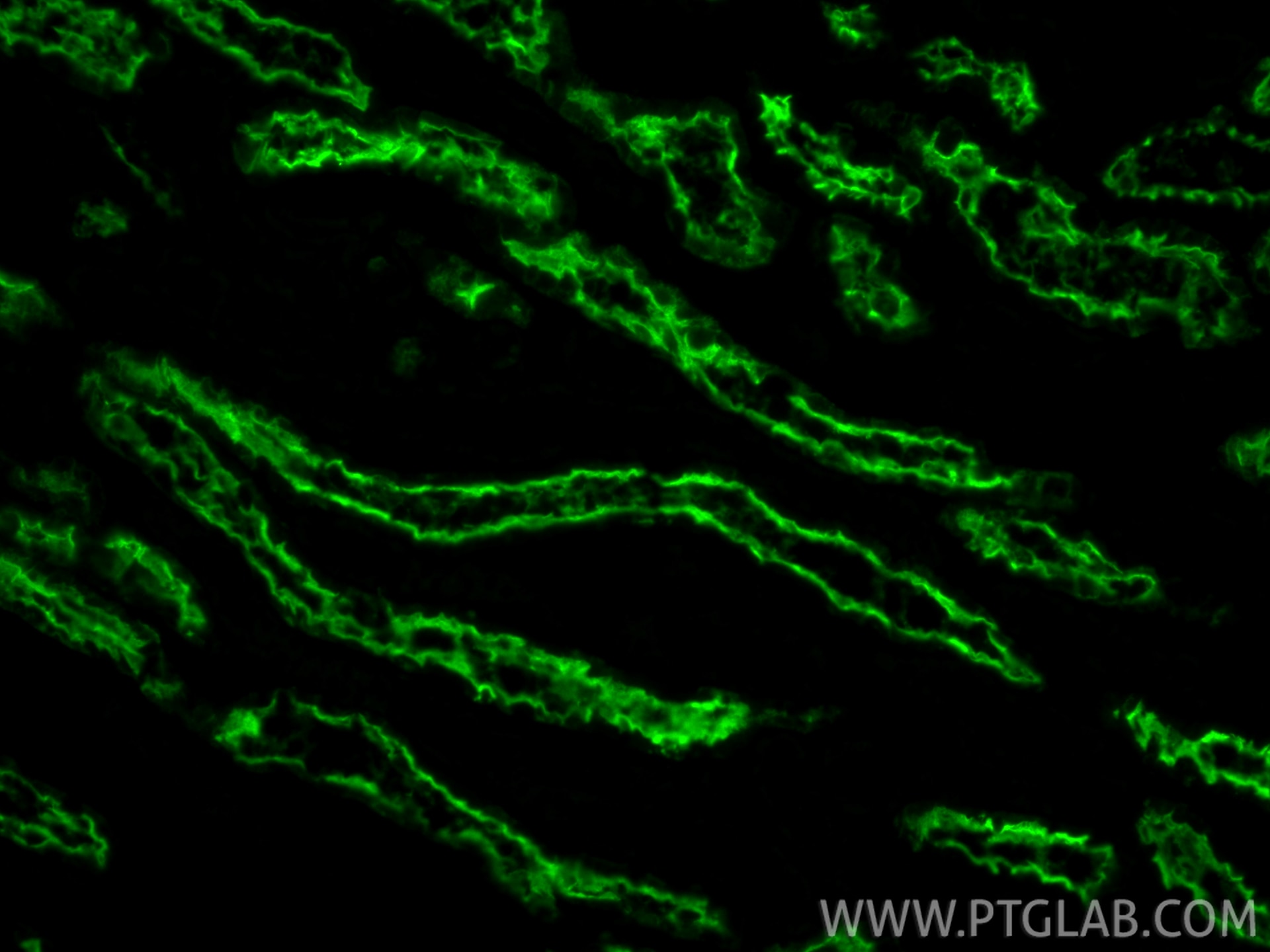 Immunofluorescence (IF) / fluorescent staining of human kidney tissue using ACE2 Polyclonal antibody (28868-1-AP)