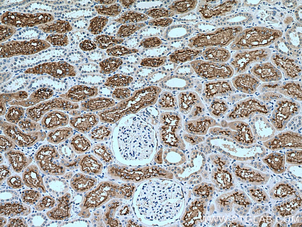 Immunohistochemistry (IHC) staining of human kidney tissue using ACE2 Polyclonal antibody (28868-1-AP)