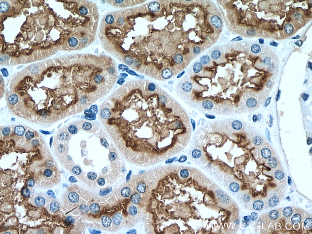 Immunohistochemistry (IHC) staining of human kidney tissue using ACE2 Polyclonal antibody (28868-1-AP)