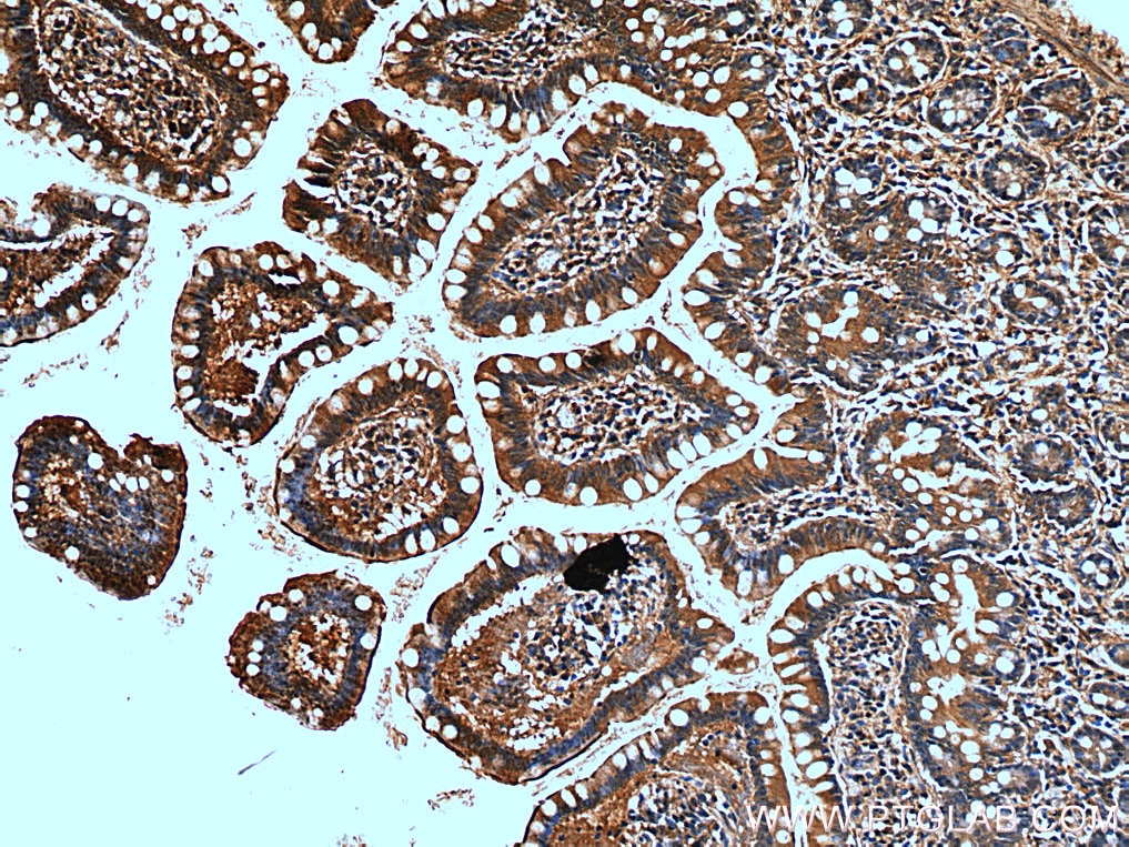 Immunohistochemistry (IHC) staining of human small intestine tissue using ACE2 Polyclonal antibody (28868-1-AP)
