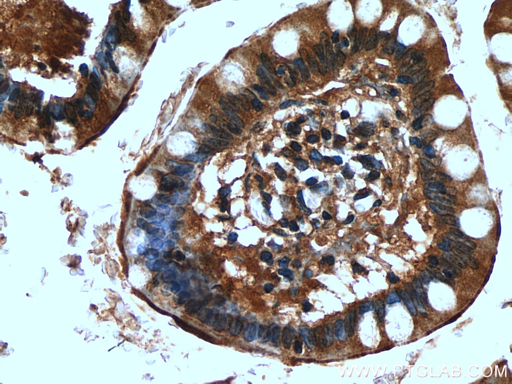 Immunohistochemistry (IHC) staining of human small intestine tissue using ACE2 Polyclonal antibody (28868-1-AP)