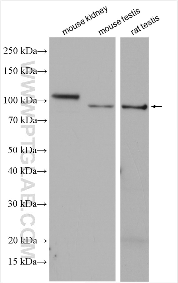 Western Blot (WB) analysis of various lysates using ACE2 Polyclonal antibody (28868-1-AP)