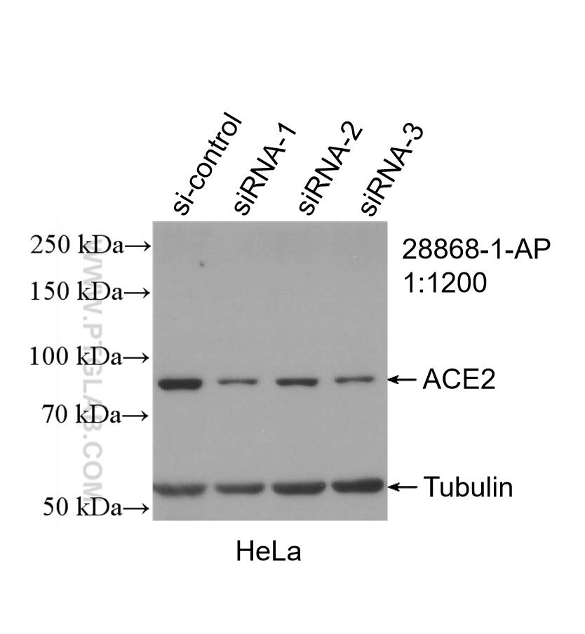 Western Blot (WB) analysis of HeLa cells using ACE2 Polyclonal antibody (28868-1-AP)