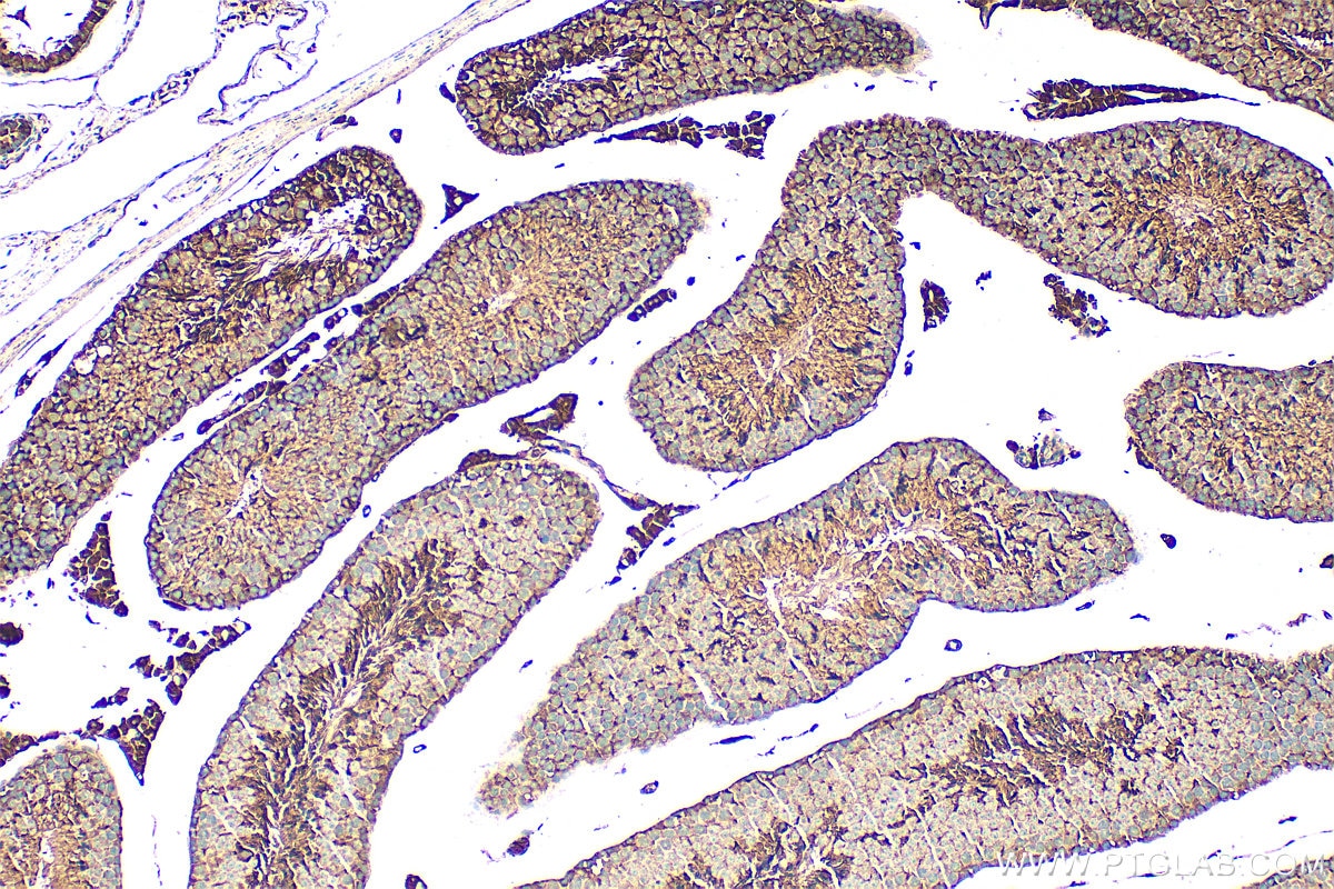 Immunohistochemistry (IHC) staining of mouse testis tissue using ACE2 Polyclonal antibody (31518-1-AP)