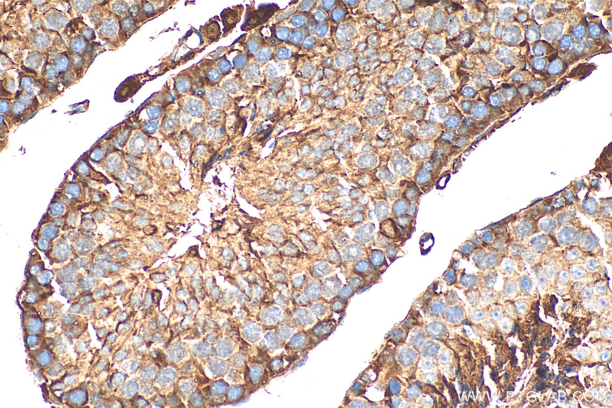 Immunohistochemistry (IHC) staining of mouse testis tissue using ACE2 Polyclonal antibody (31518-1-AP)