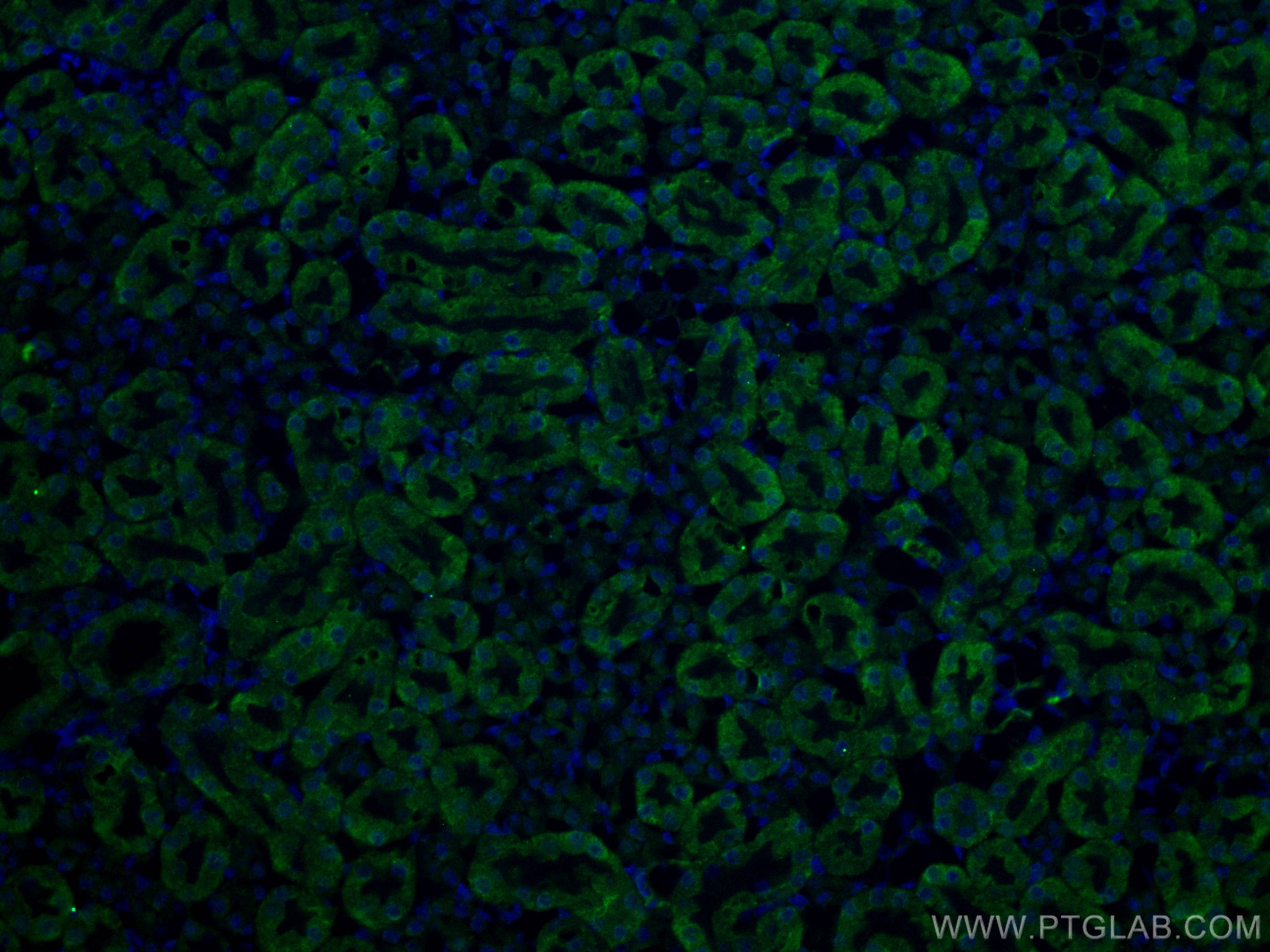 Immunofluorescence (IF) / fluorescent staining of mouse kidney tissue using ACE2 Monoclonal antibody (66699-1-Ig)