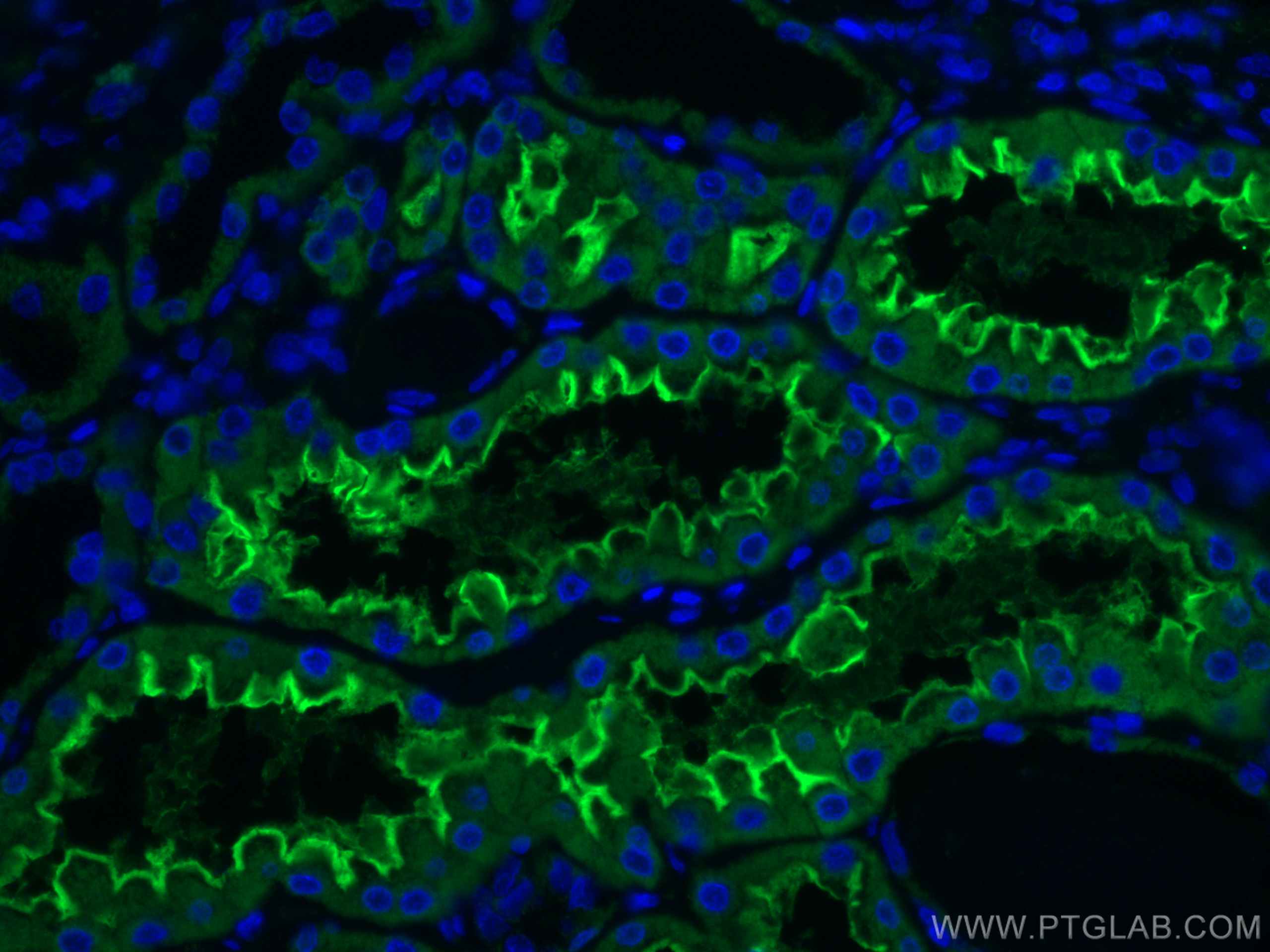 Immunofluorescence (IF) / fluorescent staining of human kidney tissue using ACE2 Monoclonal antibody (66699-1-Ig)