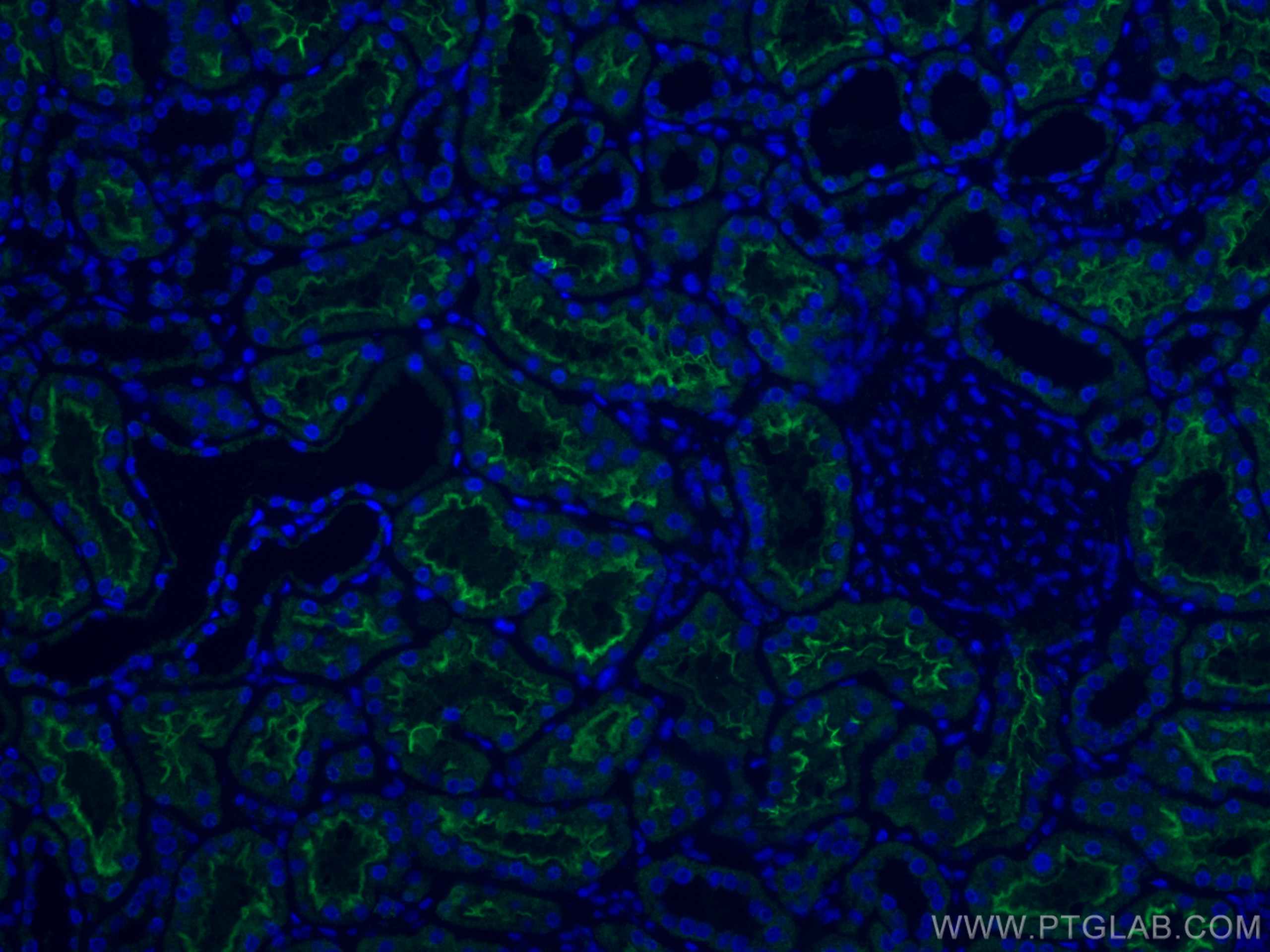 Immunofluorescence (IF) / fluorescent staining of human kidney tissue using ACE2 Monoclonal antibody (66699-1-Ig)