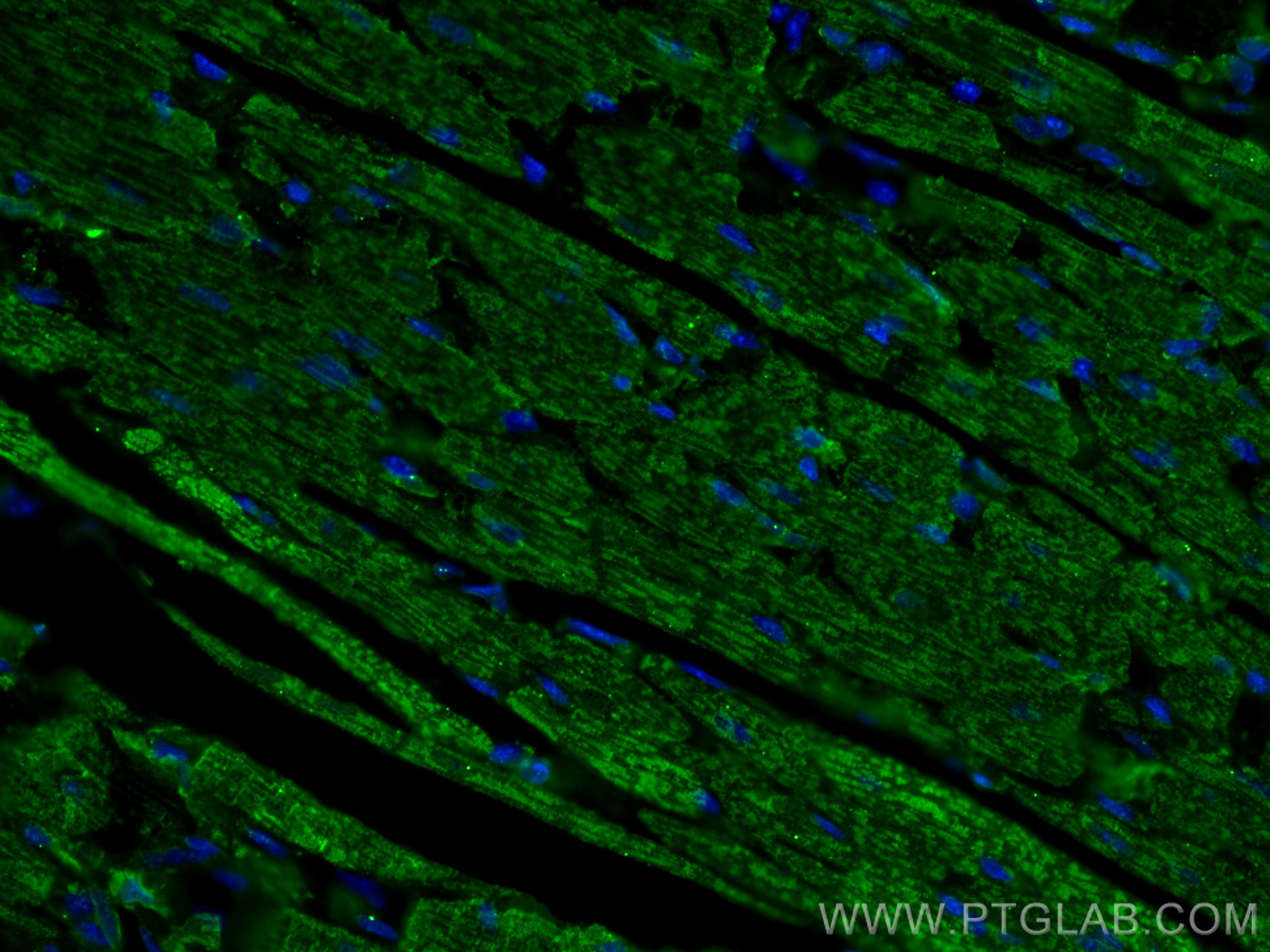 Immunofluorescence (IF) / fluorescent staining of mouse heart tissue using ACE2 Monoclonal antibody (66699-1-Ig)