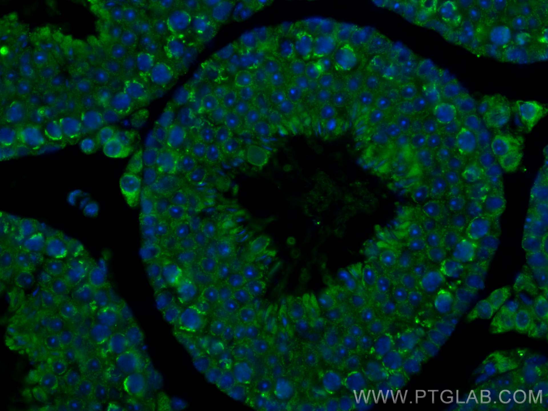 Immunofluorescence (IF) / fluorescent staining of mouse testis tissue using ACE2 Monoclonal antibody (66699-1-Ig)