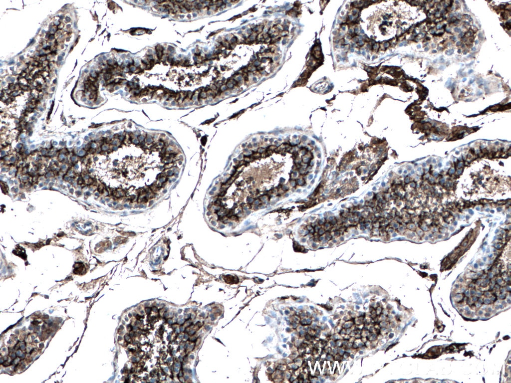 Immunohistochemistry (IHC) staining of human testis tissue using ACE2 Monoclonal antibody (66699-1-Ig)