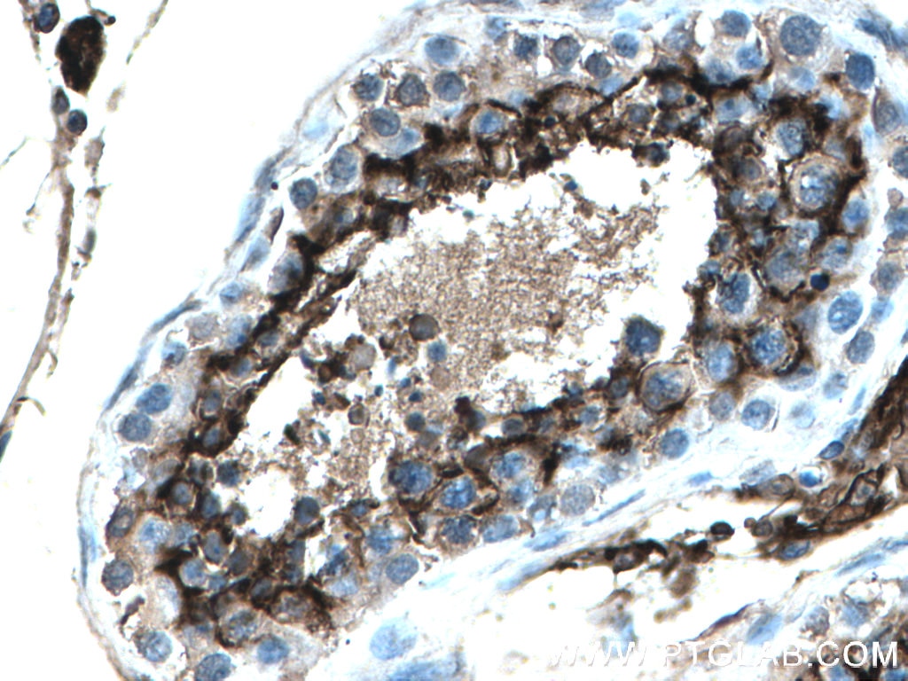 Immunohistochemistry (IHC) staining of human testis tissue using ACE2 Monoclonal antibody (66699-1-Ig)