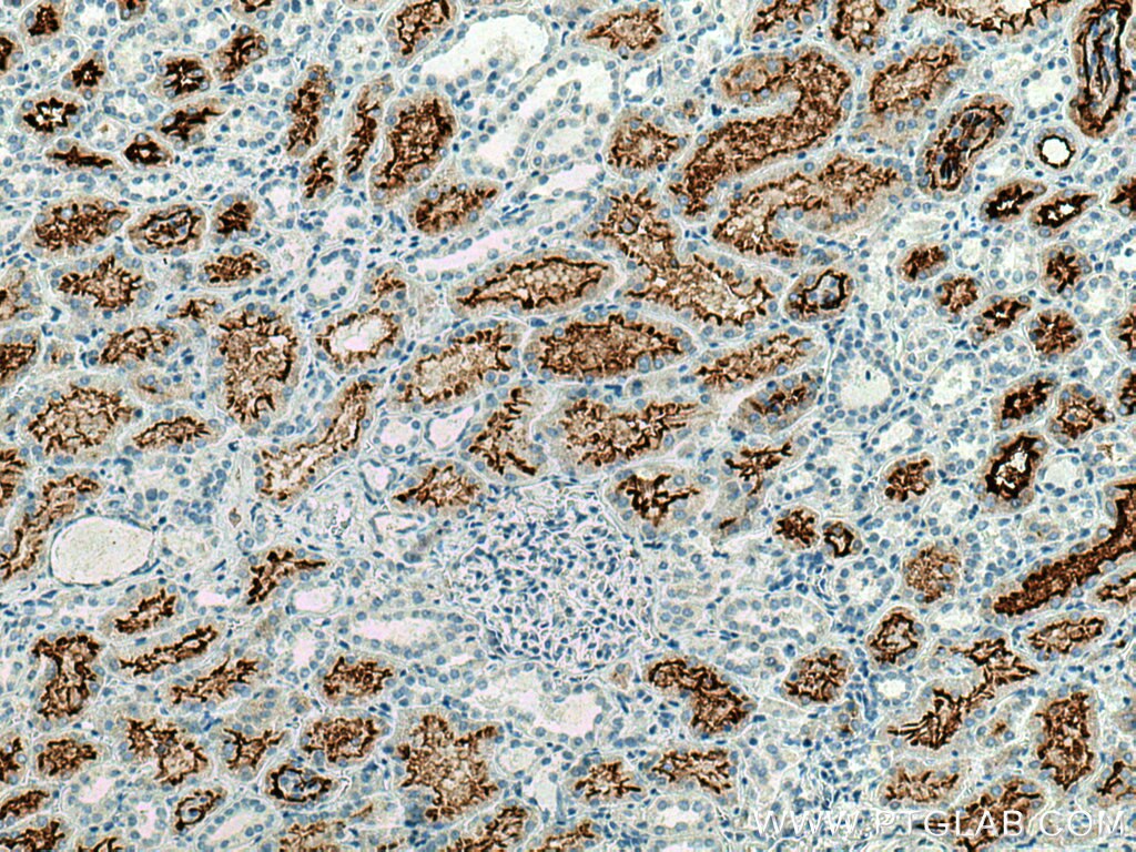 Immunohistochemistry (IHC) staining of human kidney tissue using ACE2 Monoclonal antibody (66699-1-Ig)