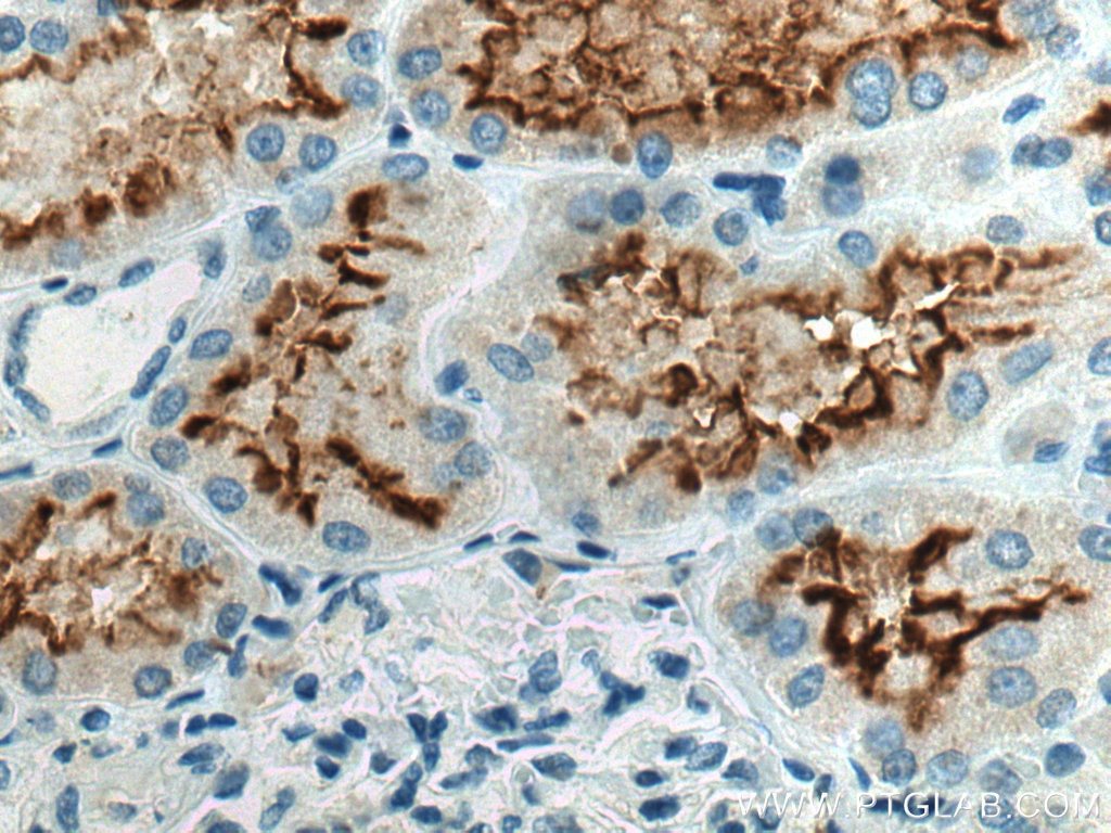 Immunohistochemistry (IHC) staining of human kidney tissue using ACE2 Monoclonal antibody (66699-1-Ig)