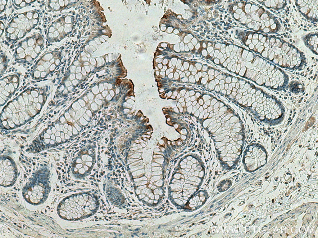 Immunohistochemistry (IHC) staining of human colon tissue using ACE2 Monoclonal antibody (66699-1-Ig)