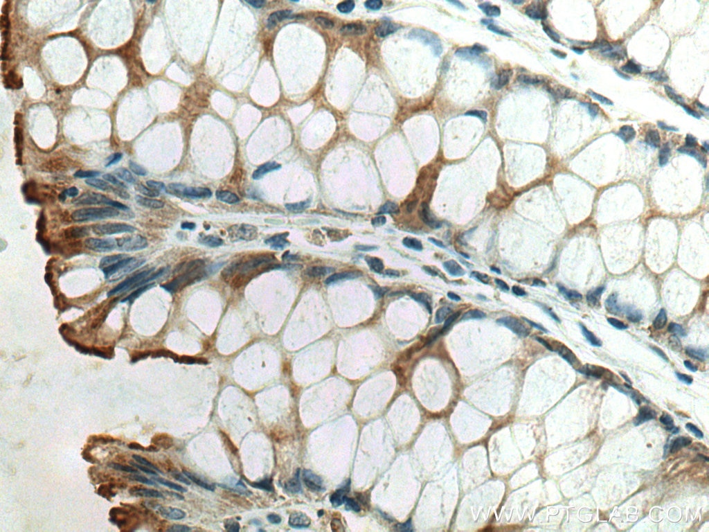 Immunohistochemistry (IHC) staining of human colon tissue using ACE2 Monoclonal antibody (66699-1-Ig)