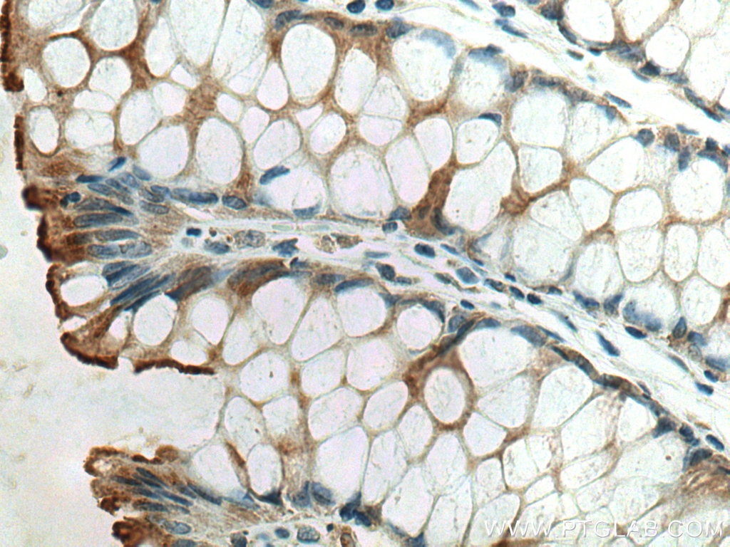 IHC staining of human colon using 66699-1-Ig