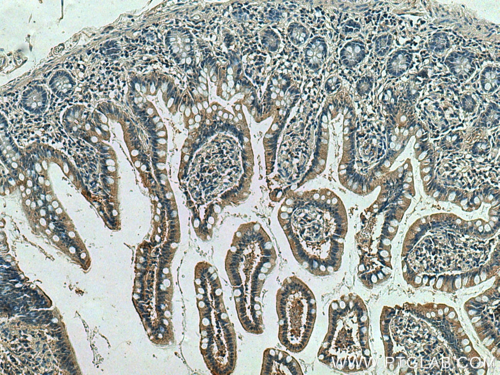 Immunohistochemistry (IHC) staining of human small intestine tissue using ACE2 Monoclonal antibody (66699-1-Ig)