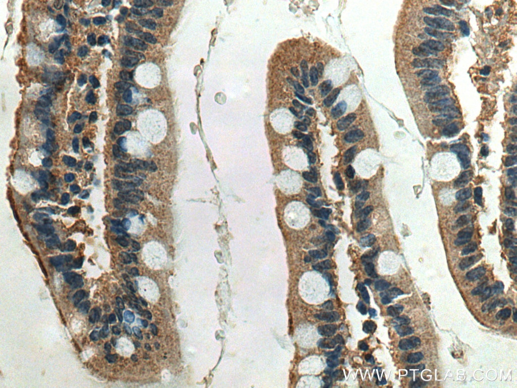 Immunohistochemistry (IHC) staining of human small intestine tissue using ACE2 Monoclonal antibody (66699-1-Ig)