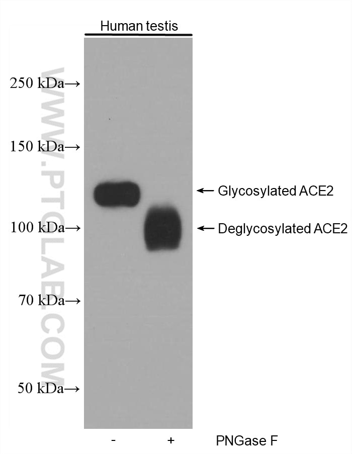 Western Blot (WB) analysis of human testis tissue using ACE2 Monoclonal antibody (66699-1-Ig)
