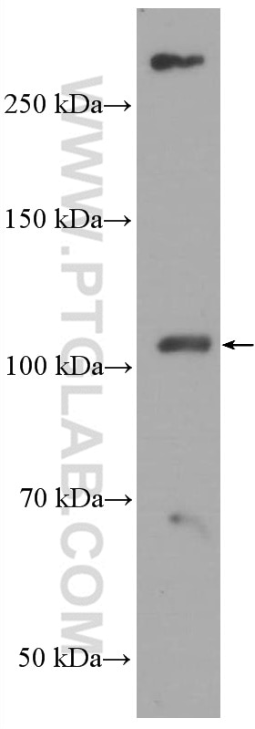 Western Blot (WB) analysis of human skeletal muscle tissue using ACE2 Monoclonal antibody (66699-1-Ig)