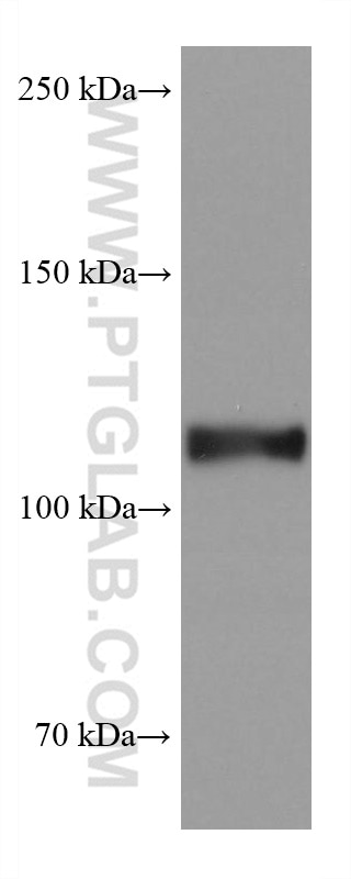 Western Blot (WB) analysis of human testis tissue using ACE2 Monoclonal antibody (66699-1-Ig)