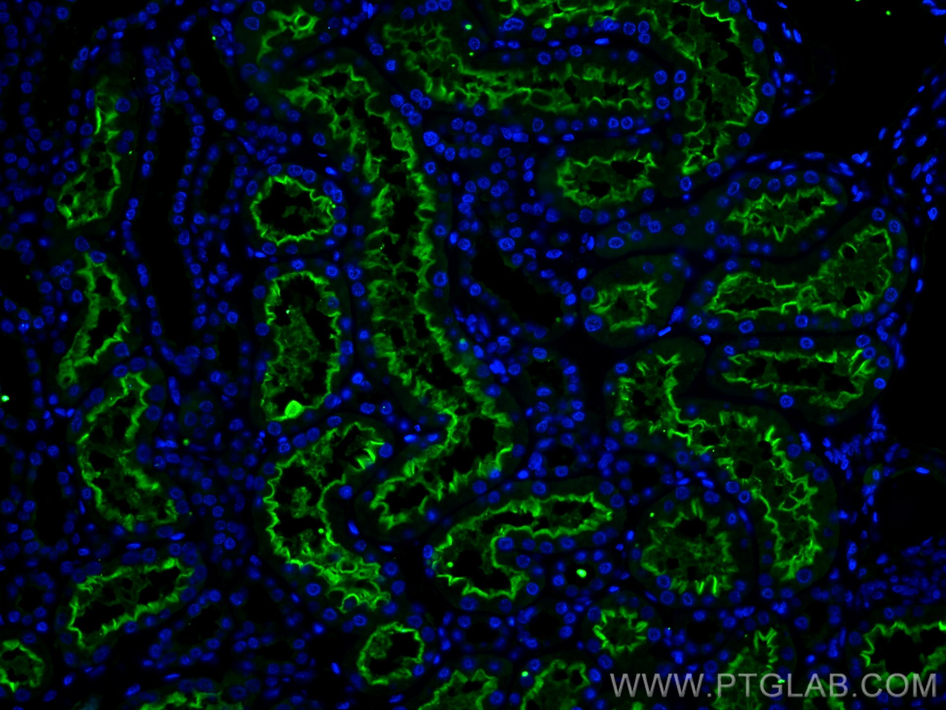 Immunofluorescence (IF) / fluorescent staining of human kidney tissue using ACE2 Recombinant antibody (80063-1-RR)