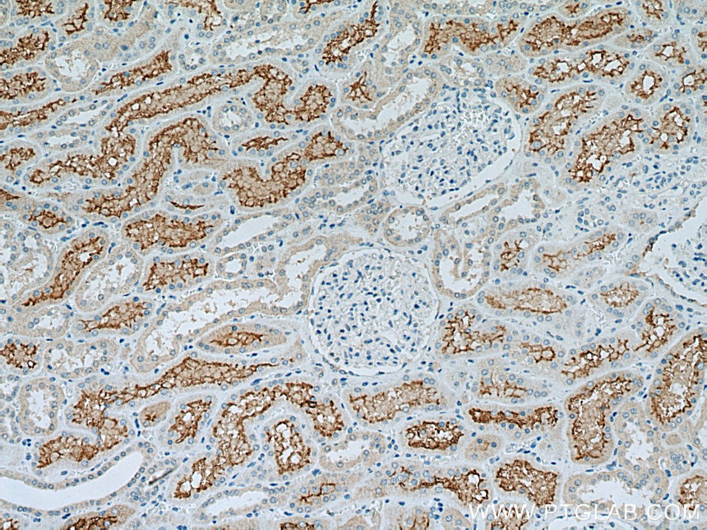 Immunohistochemistry (IHC) staining of human kidney tissue using ACE2 Recombinant antibody (80063-1-RR)