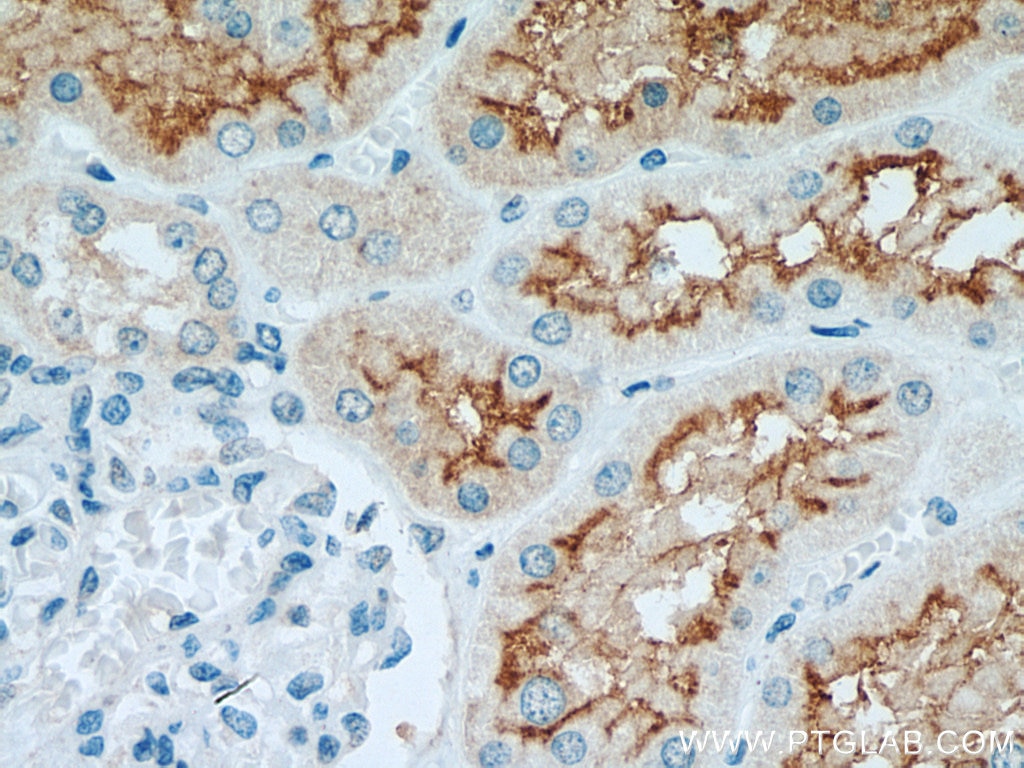 Immunohistochemistry (IHC) staining of human kidney tissue using ACE2 Recombinant antibody (80063-1-RR)
