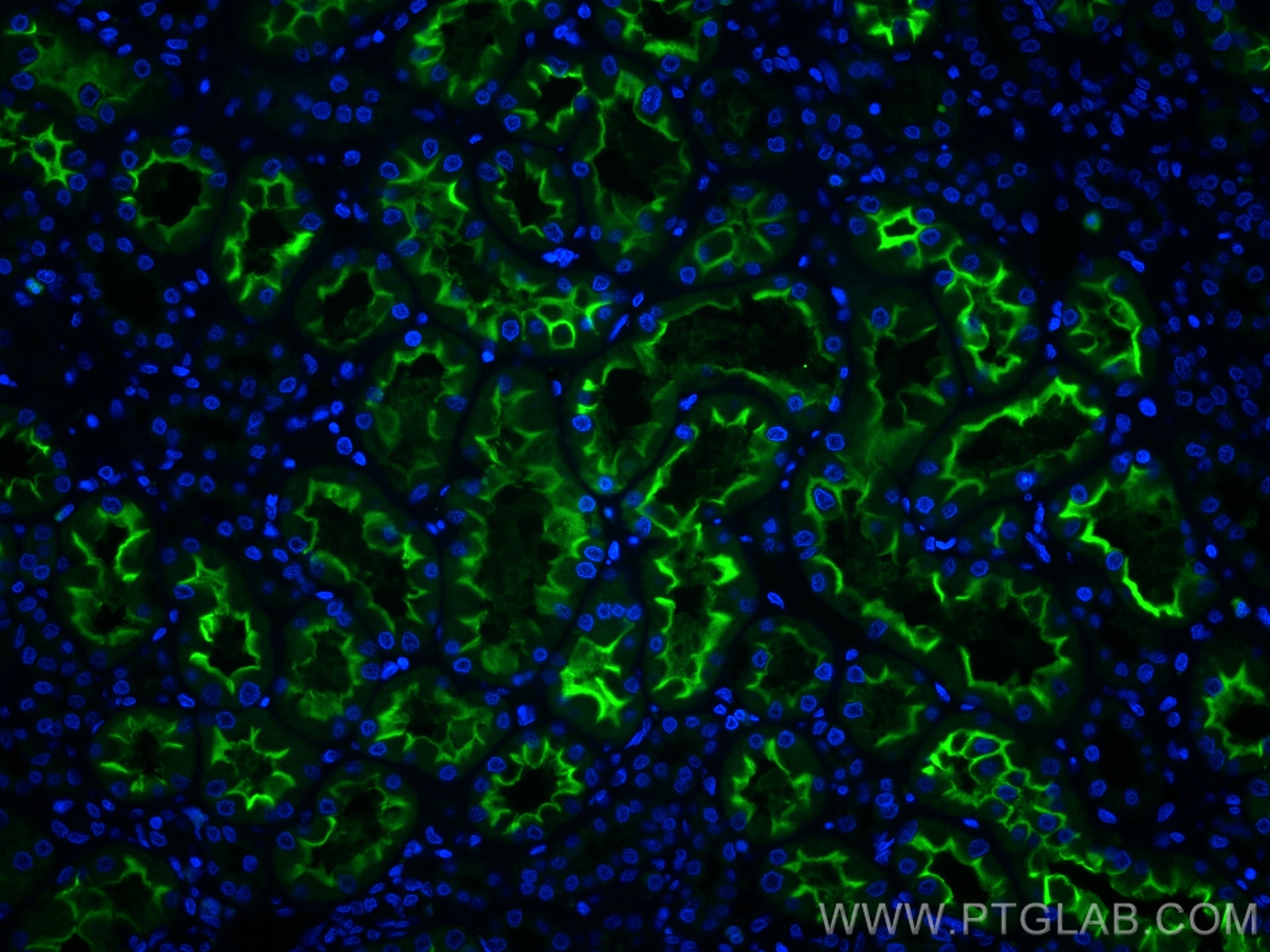 Immunofluorescence (IF) / fluorescent staining of human kidney tissue using CoraLite® Plus 488-conjugated ACE2 Monoclonal anti (CL488-66699)