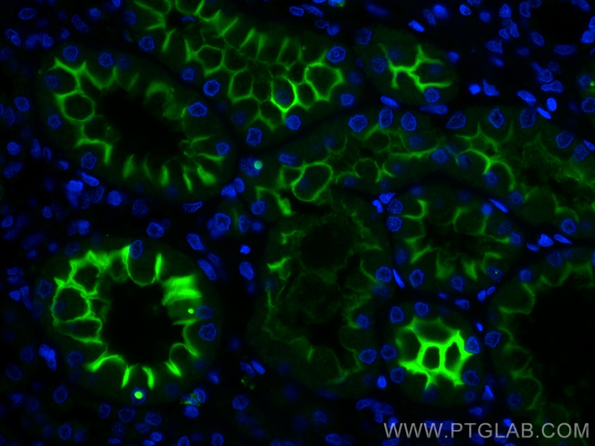 Immunofluorescence (IF) / fluorescent staining of human kidney tissue using CoraLite® Plus 488-conjugated ACE2 Monoclonal anti (CL488-66699)