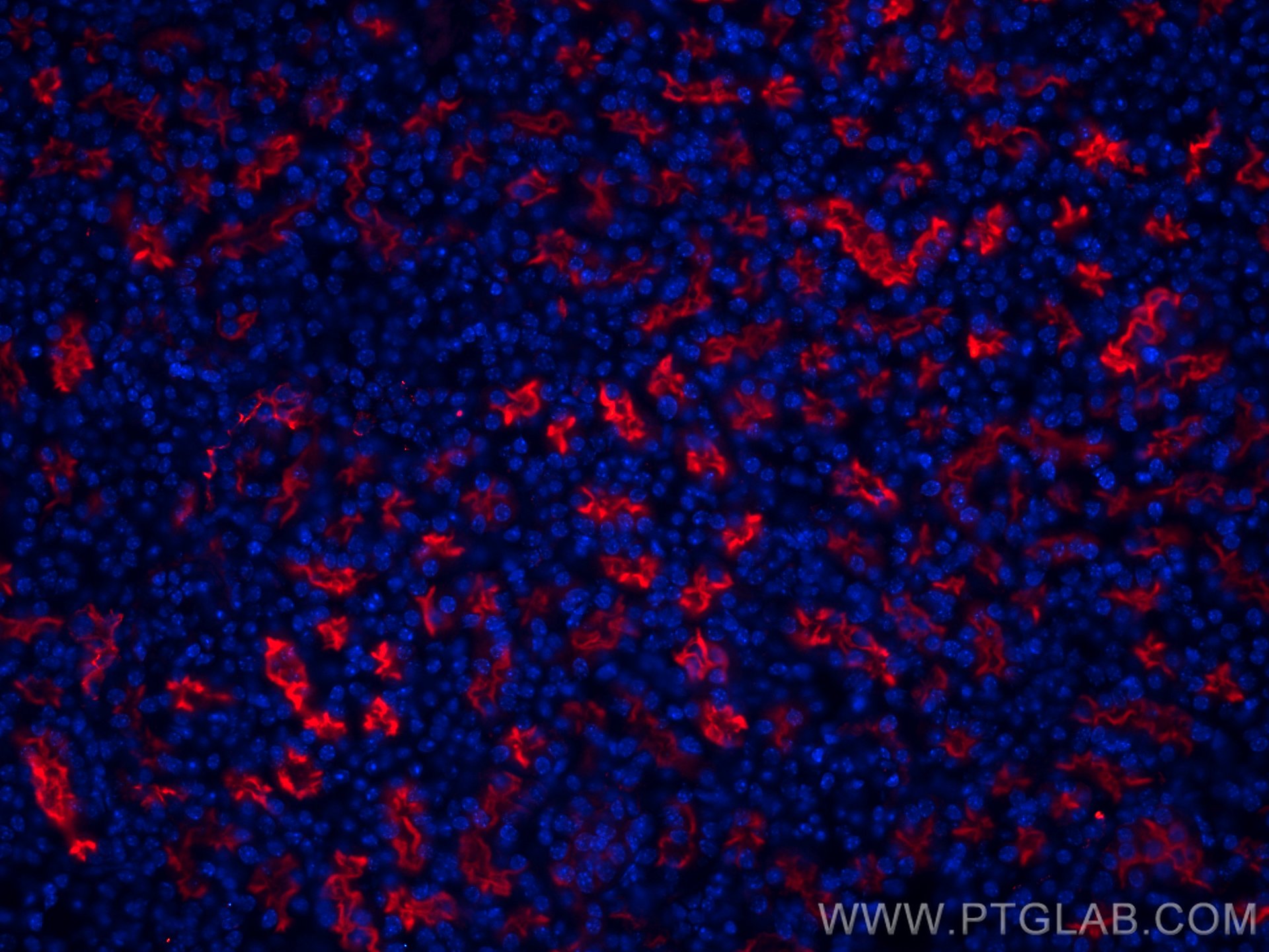 IF Staining of mouse kidney using CL594-21115
