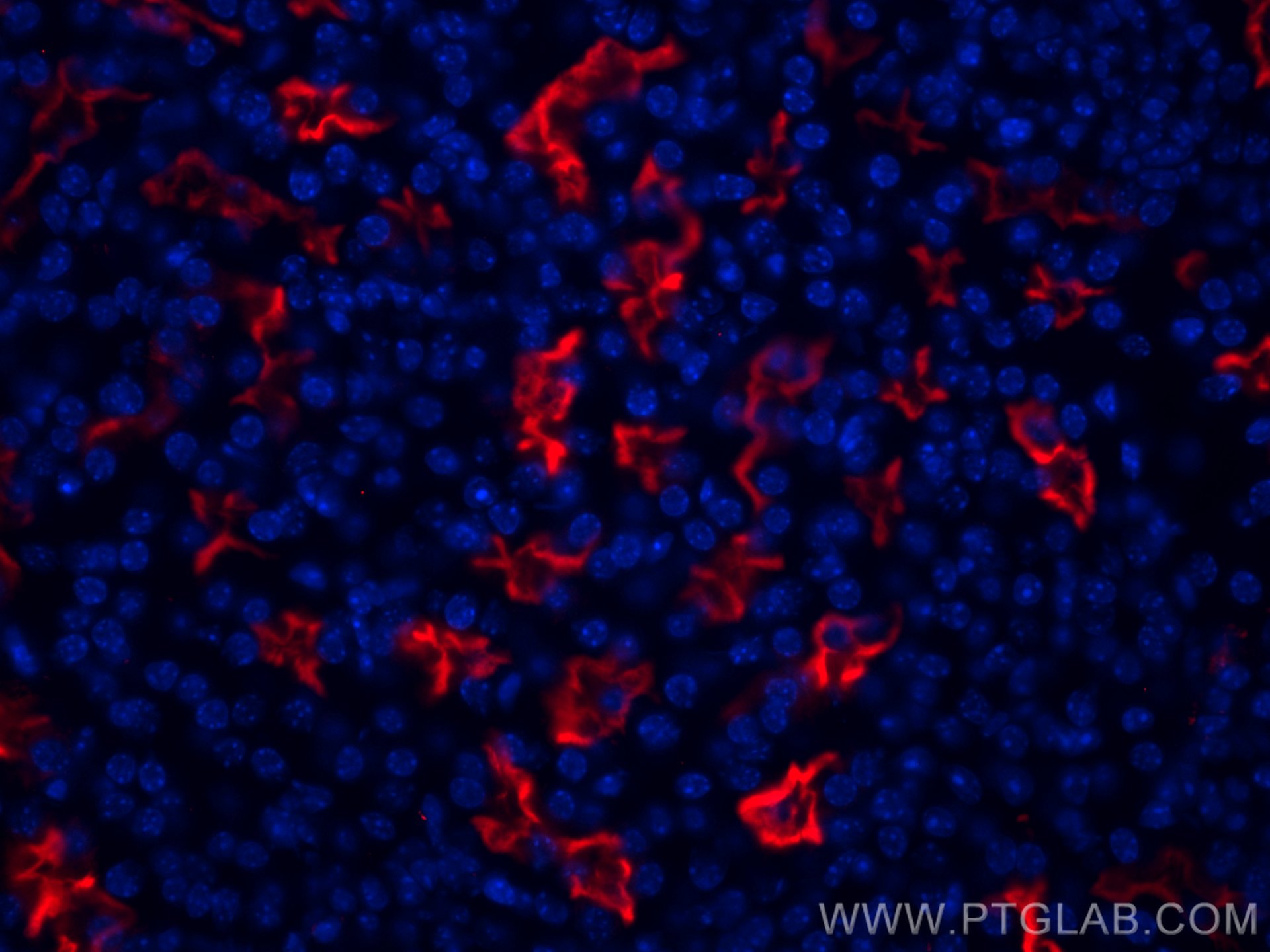 Immunofluorescence (IF) / fluorescent staining of mouse kidney tissue using CoraLite®594-conjugated ACE2 Polyclonal antibody (CL594-21115)