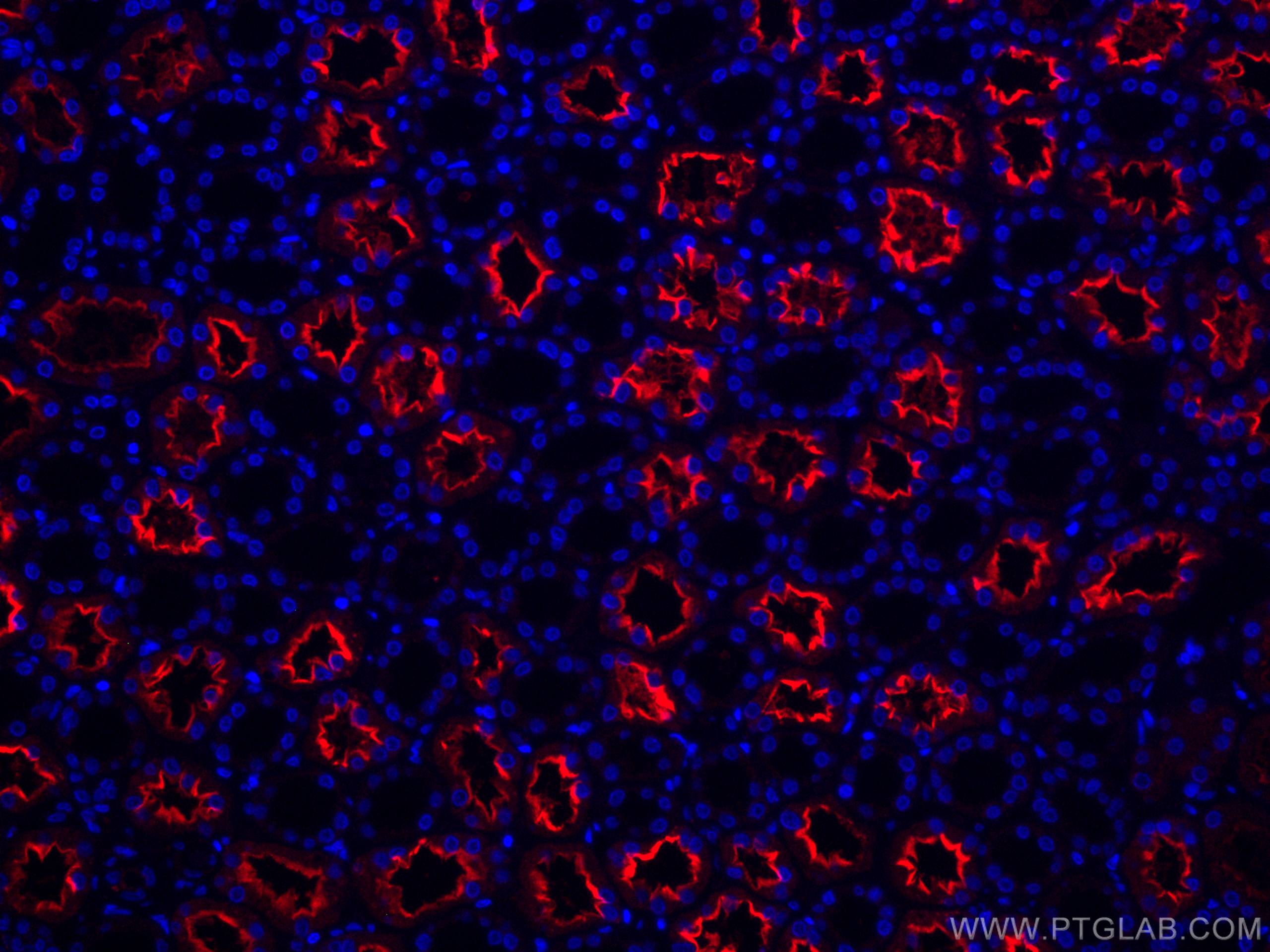 Immunofluorescence (IF) / fluorescent staining of human kidney tissue using CoraLite®594-conjugated ACE2 Monoclonal antibody (CL594-66699)