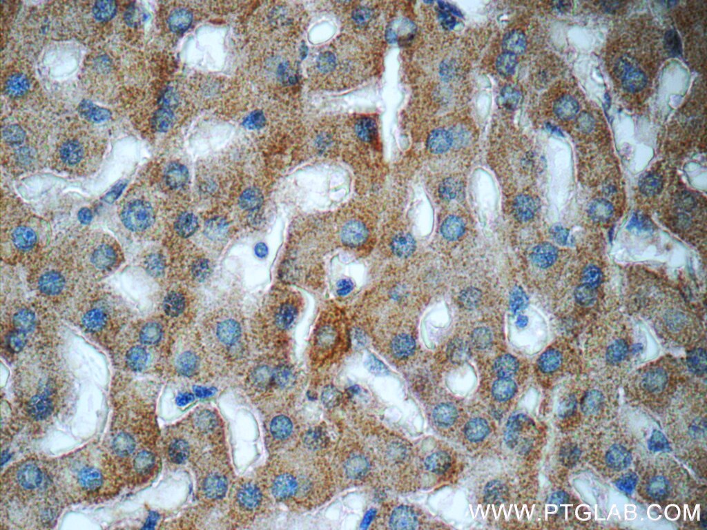 Acetylcholinesterase Polyclonal antibody