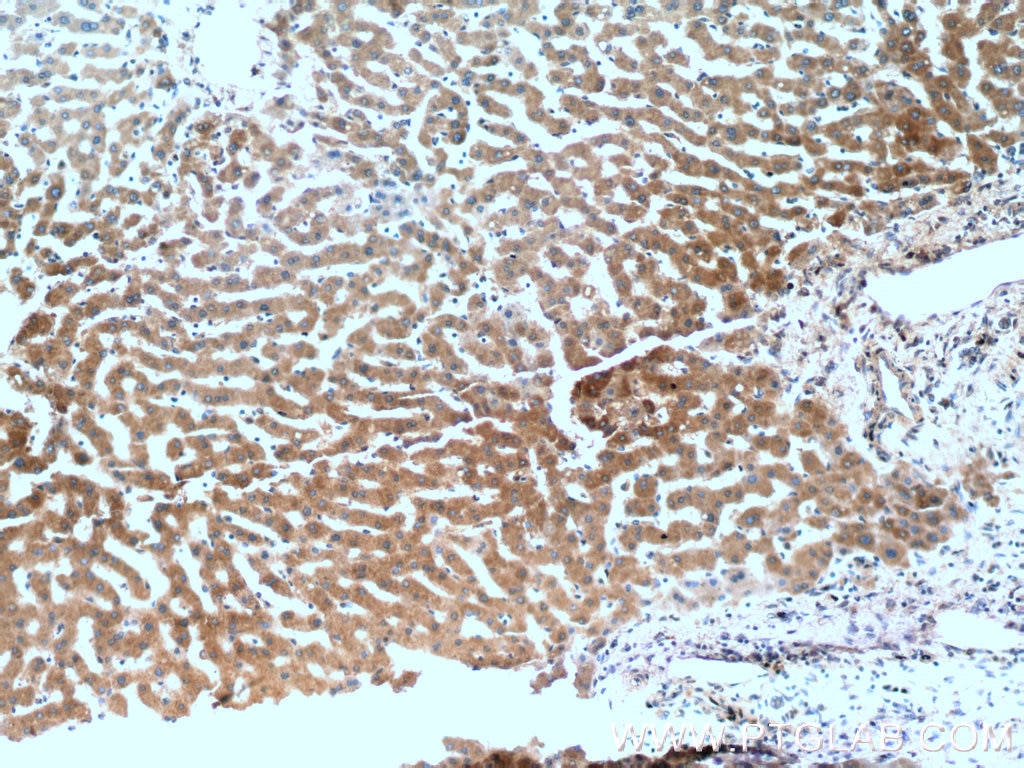 Immunohistochemistry (IHC) staining of human liver tissue using Acetylcholinesterase Polyclonal antibody (17975-1-AP)