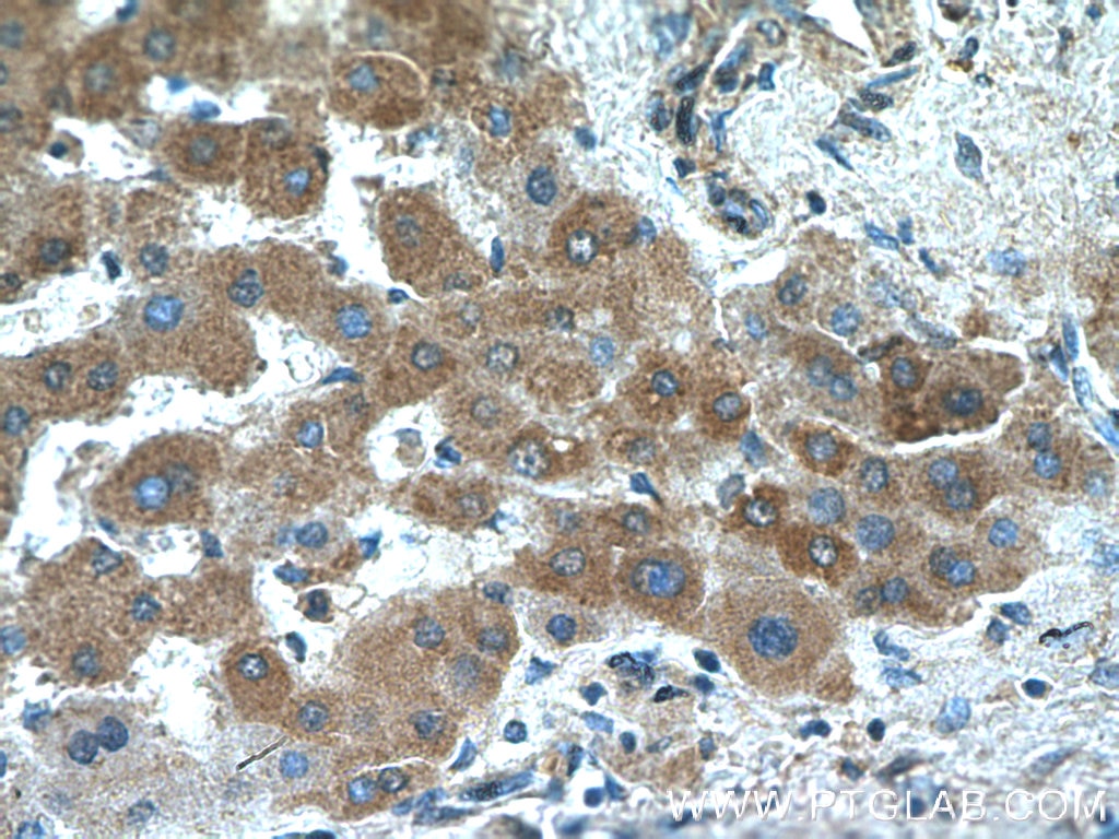 Immunohistochemistry (IHC) staining of human liver tissue using Acetylcholinesterase Polyclonal antibody (17975-1-AP)