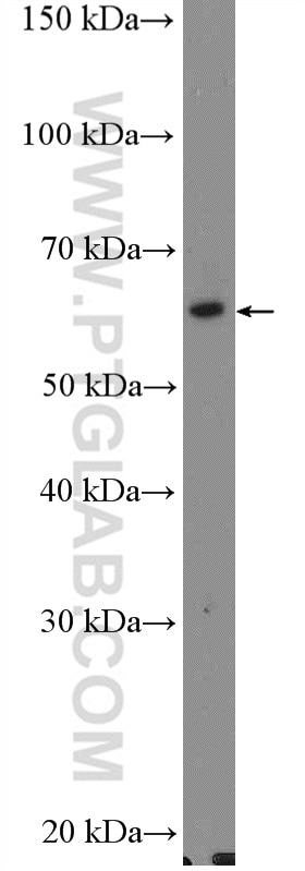 Western Blot (WB) analysis of HEK-293 cells using Acetylcholinesterase Polyclonal antibody (17975-1-AP)