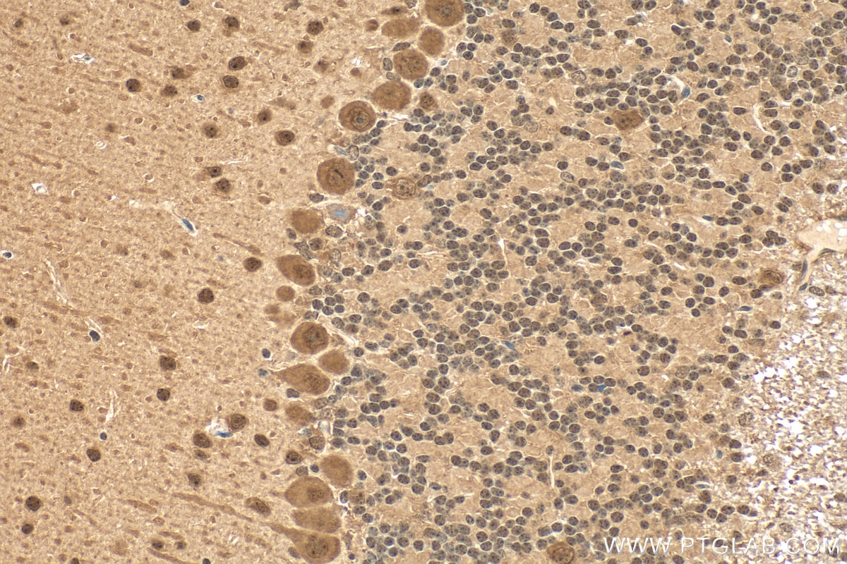 Immunohistochemistry (IHC) staining of mouse cerebellum tissue using ACIN1 Polyclonal antibody (23937-1-AP)