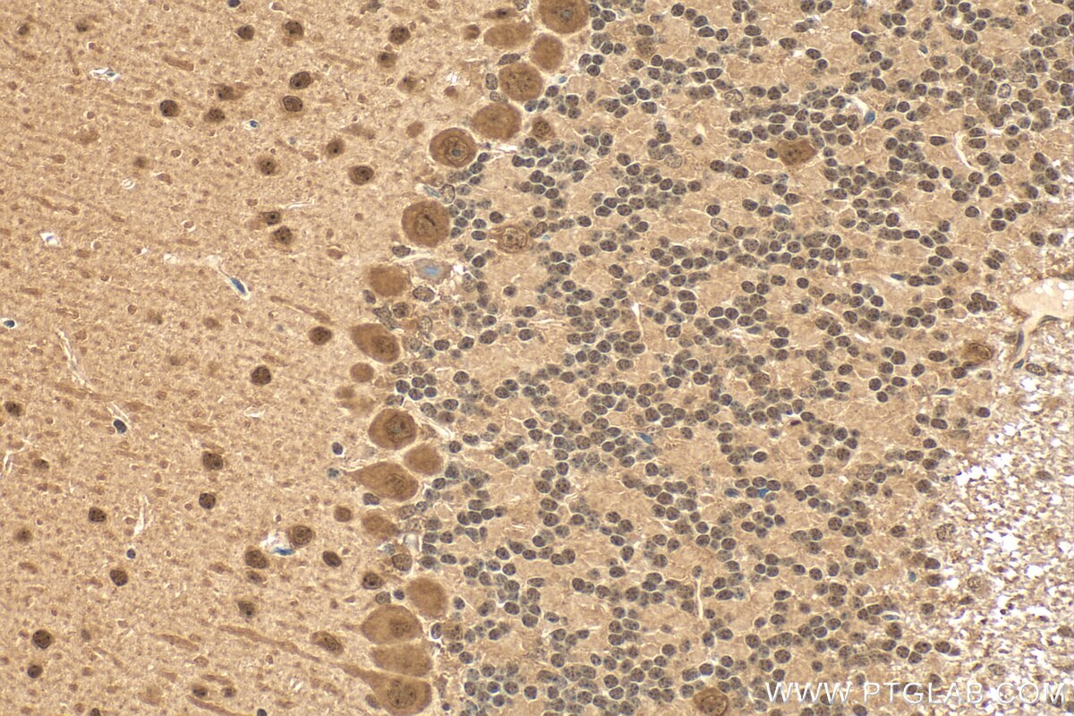 Immunohistochemistry (IHC) staining of mouse cerebellum tissue using ACIN1 Polyclonal antibody (23937-1-AP)