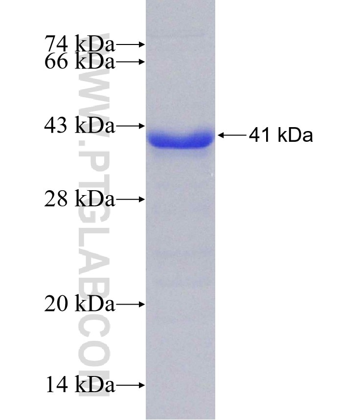 ACIN1 fusion protein Ag30520 SDS-PAGE ACIN1 fusion protein Ag30520 SDS-PAGE