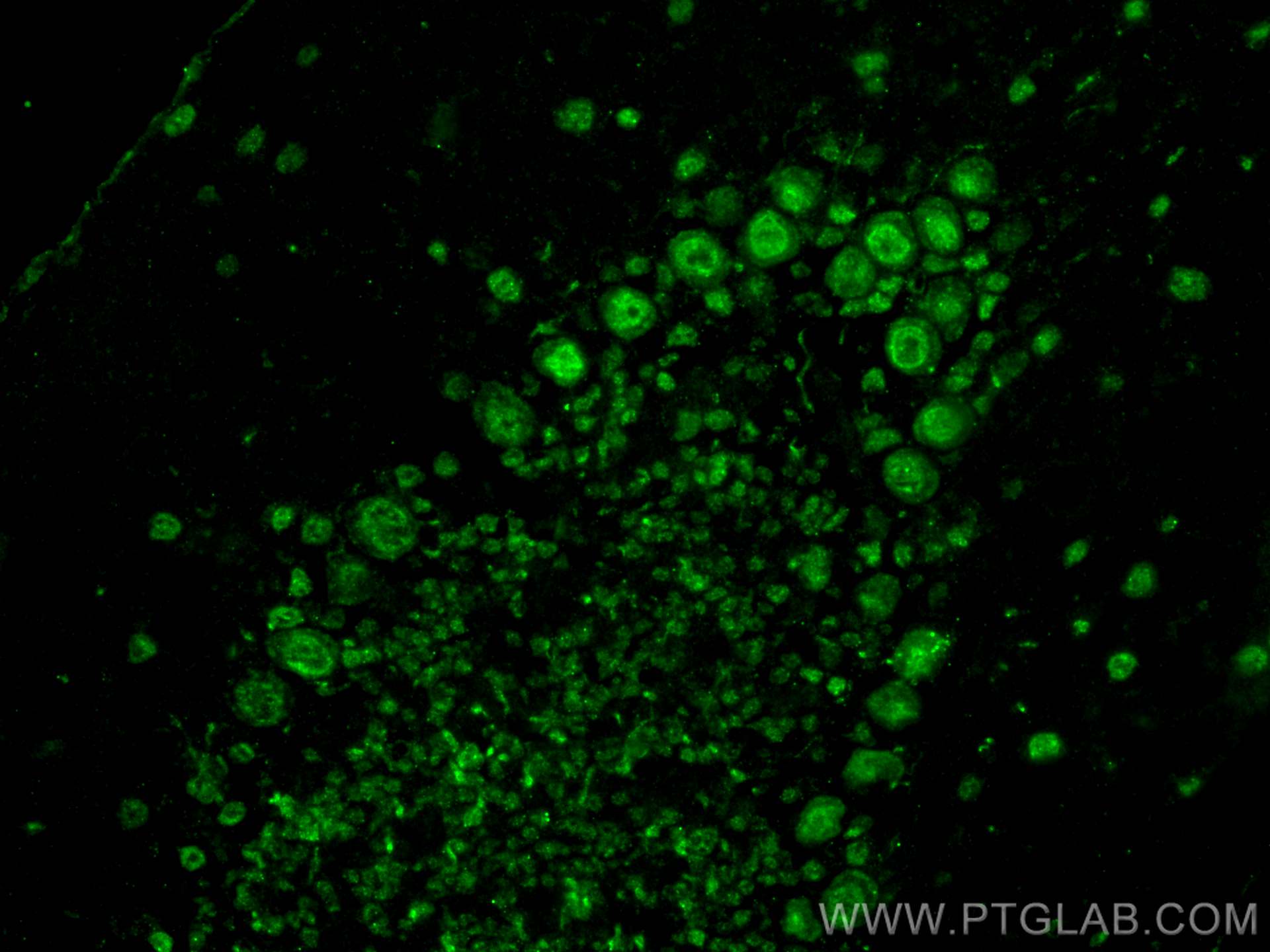 Immunofluorescence (IF) / fluorescent staining of mouse cerebellum tissue using ACIN1-L specific Polyclonal antibody (30522-1-AP)