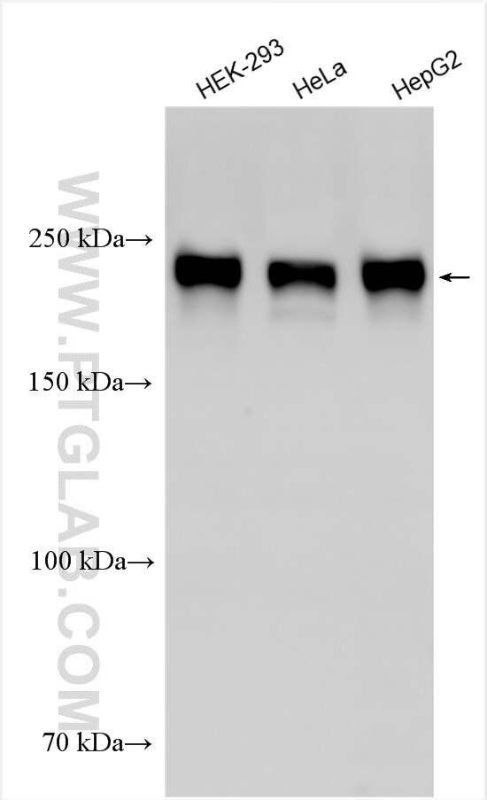 Western Blot (WB) analysis of various lysates using ACIN1-L specific Polyclonal antibody (30522-1-AP)