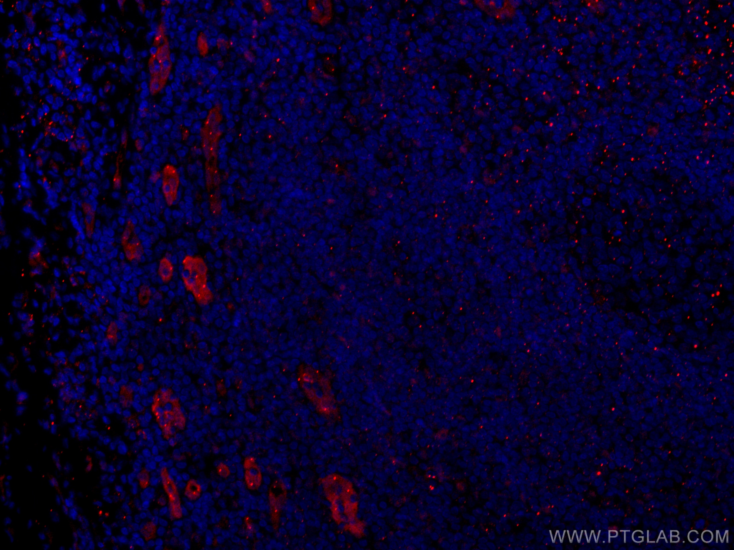 Immunofluorescence (IF) / fluorescent staining of human tonsillitis tissue using CoraLite®594-conjugated ACKR2 Monoclonal antibody (CL594-60046)