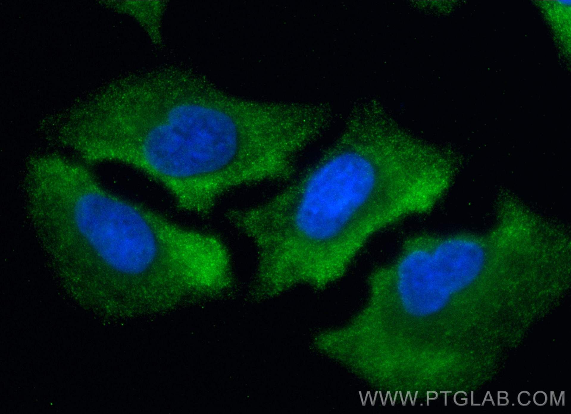 Immunofluorescence (IF) / fluorescent staining of A549 cells using ACLY Polyclonal antibody (15421-1-AP)
