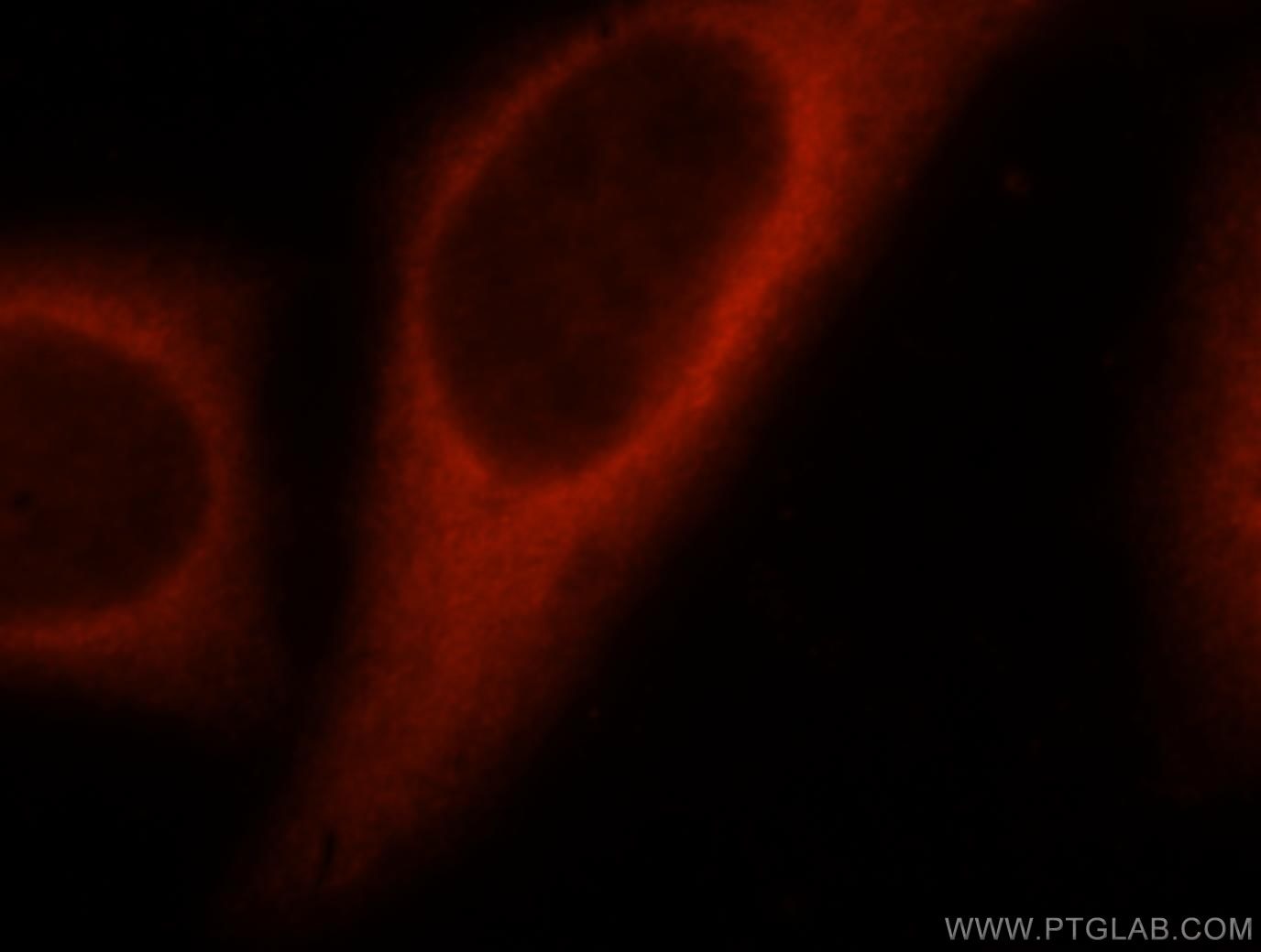 Immunofluorescence (IF) / fluorescent staining of HepG2 cells using ACLY Polyclonal antibody (15421-1-AP)